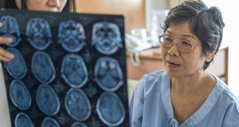 Rastet e demencës pritet të trefishohen në të gjithë botën deri në vitin 2050