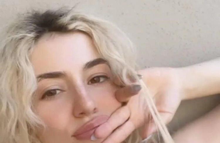 Ava Max pësoi rënie të flokëve nga COVID-19