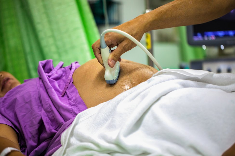 Mjeku nga Holanda përdori spermën e tij te disa gra, për 13 vjet lindën 21 fëmijë