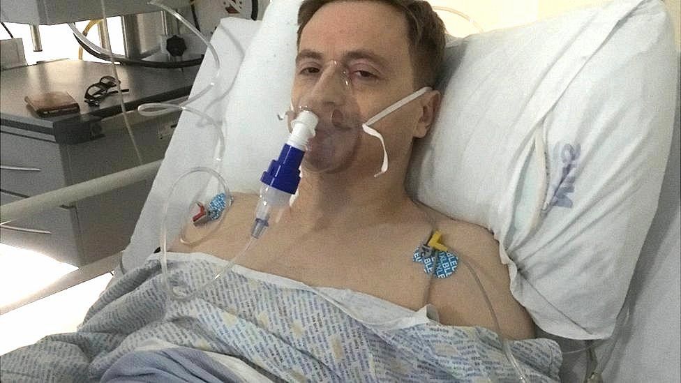 46-vjeçari u trondit kur kuptoi se kishte katër veshka në trupin e tij pas operacionit