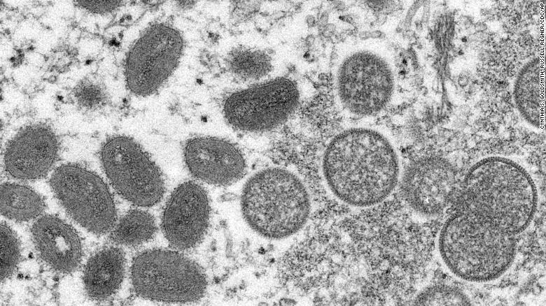 OBSh: Përhapja e lisë së majmunëve arrin në 257 raste të konfirmuara në mbarë botën