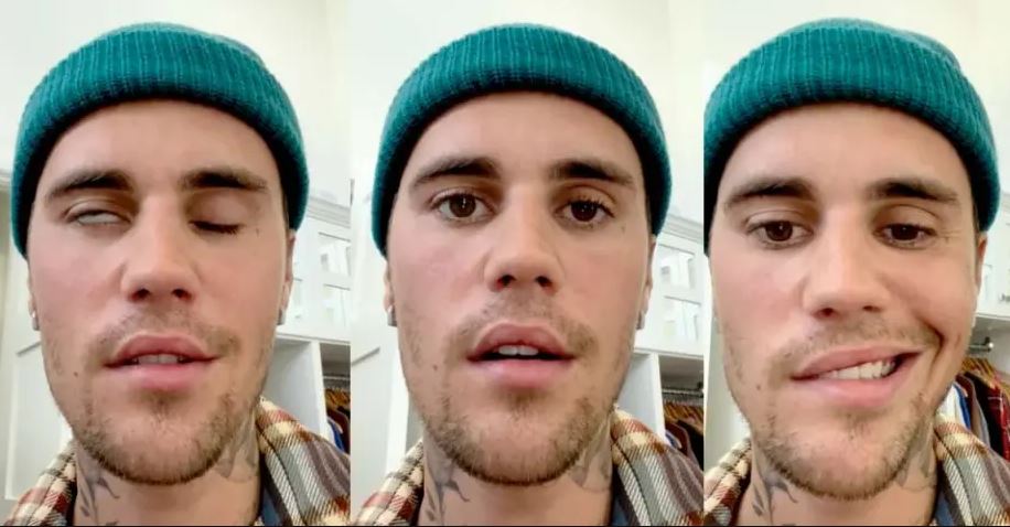 Çka është sindroma Ramsay Hunt, virusi nga i cili po vuan Justin Bieber?