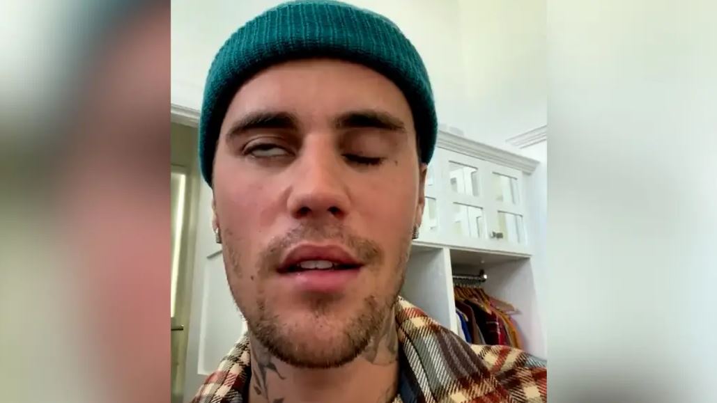 Justin Bieber po tregon shenjat e para të shërimit, thotë kirurgu