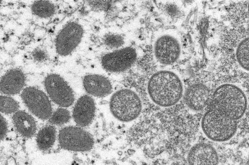 Mbi 1 mijë raste të lisë së majmunëve të konfirmuara në mbarë botën