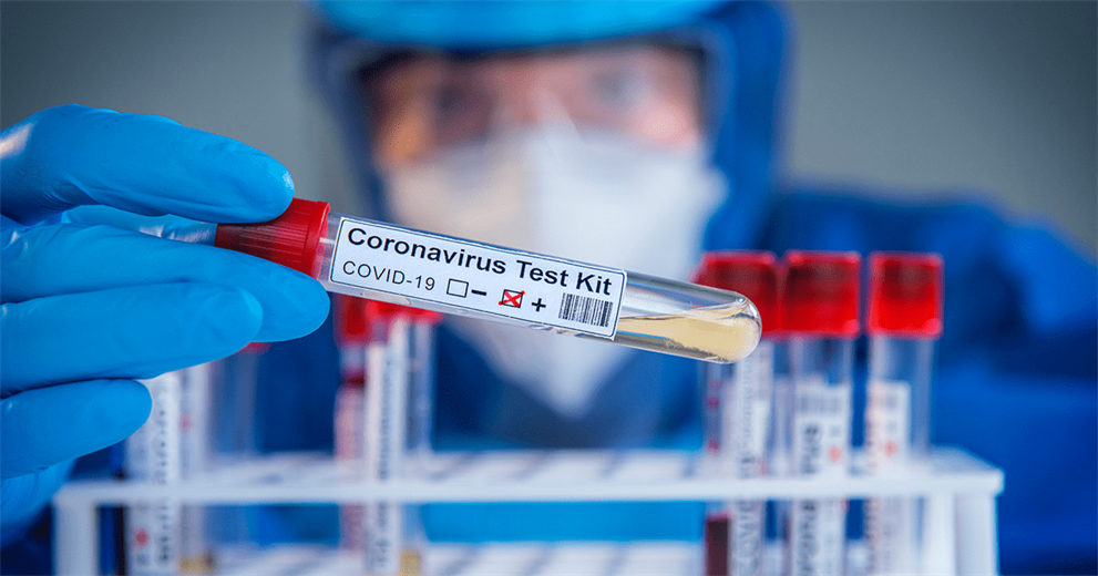 Hulumtimet e reja thonë se COVID-19 nuk doli nga laboratori