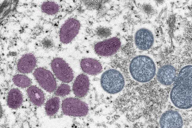 ShBA-ja do t'i lëshojë rreth 150 mijë doza të vaksinës kundër lisë së majmunëve nga stoku kombëtar