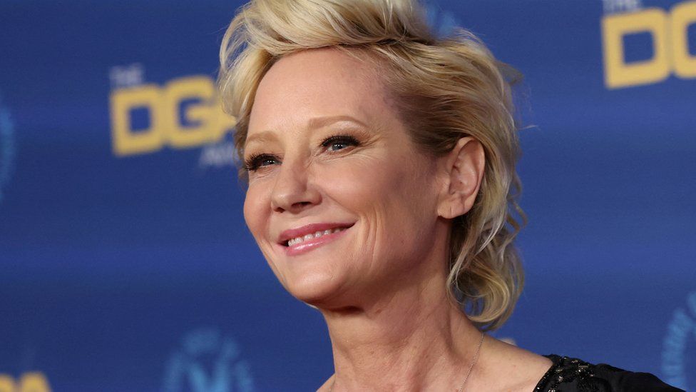 Anne Heche: Aktorja amerikane nuk pritet të mbijetojë, thotë familja