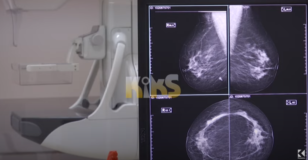 QKUK nuk ka ilaç kundër kancerit të gjirit dhe të lukthit, pacientët privohen nga trajtimi (VIDEO)