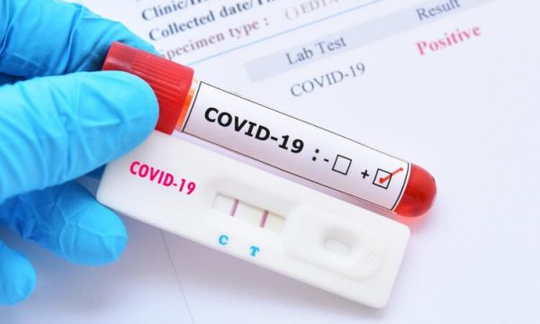 Kosovë: Mbi 1 mijë e 300 raste aktive me koronavirus