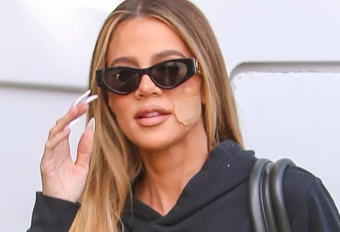 Khloe Kardashian heq një tumor nga fytyra