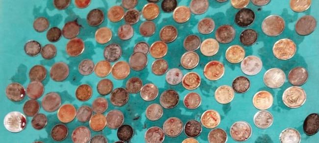 Indi: Burrit i hiqen 187 monedha nga barku (FOTO)