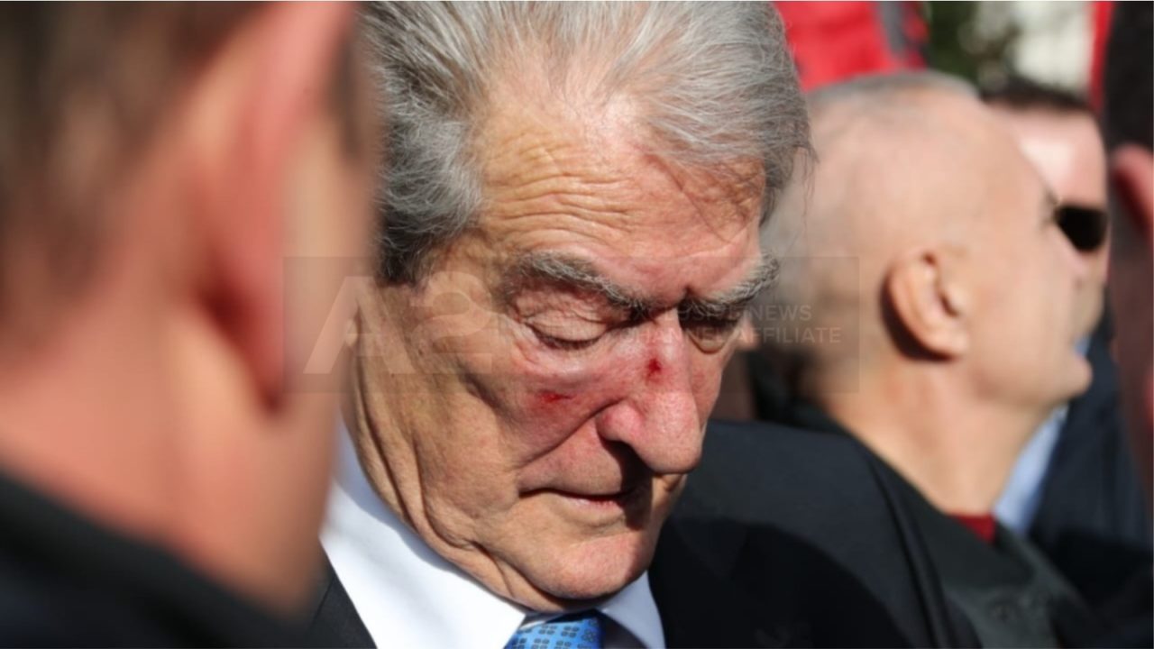 Pasi u godit me grusht, Berisha me çarje në hundë dhe mollëz