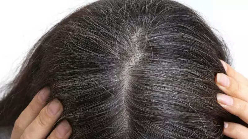 Thinja e parakohshme e flokëve mund të tregojë këto probleme shëndetësore