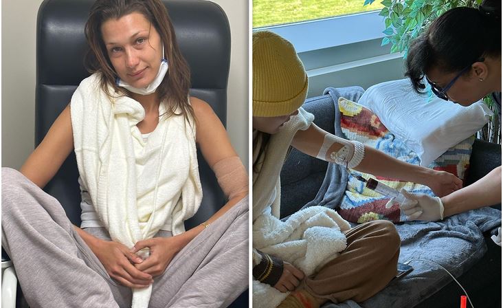 Bella Hadid i bën 100 ditë prej trajtimit intensiv të sëmundjes Lyme