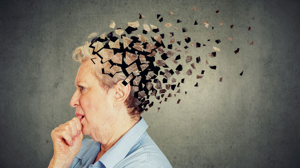 Alzheimeri