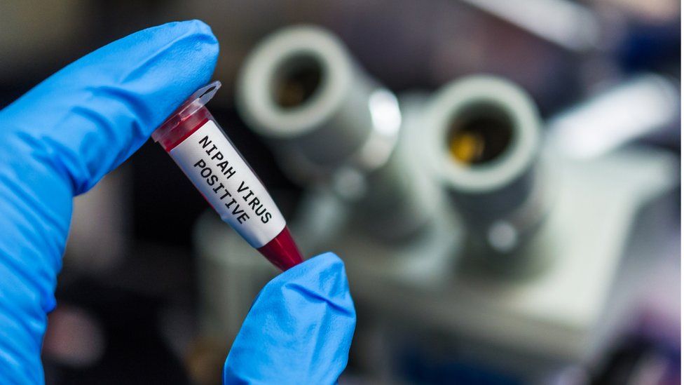 Virusi Nipah alarmon Indinë, konfirmohen dy vdekje