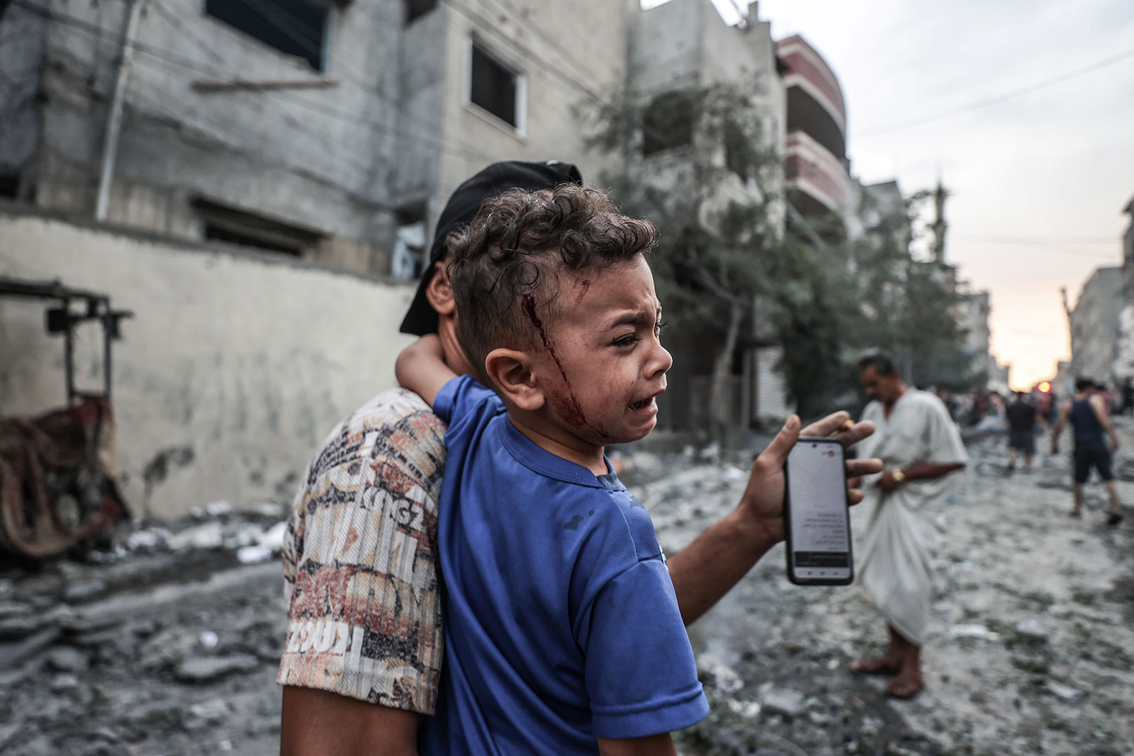 “Rreth 40 për qind e të plagosurve nga sulmet në Gaza janë fëmijë”