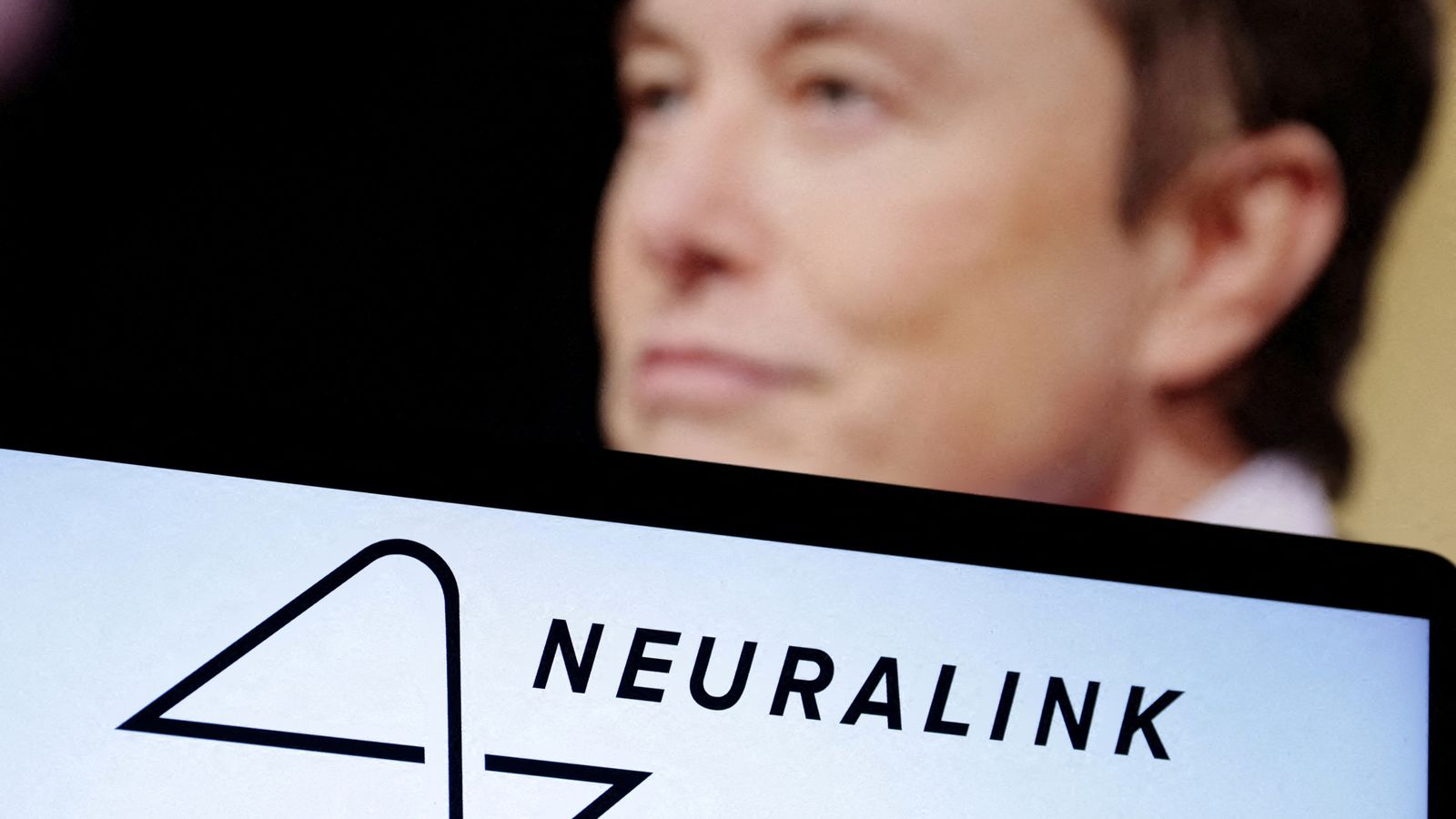 Pacienti i parë njerëzor merr çipin e trurit nga kompania Neuralink e Elon Muskut