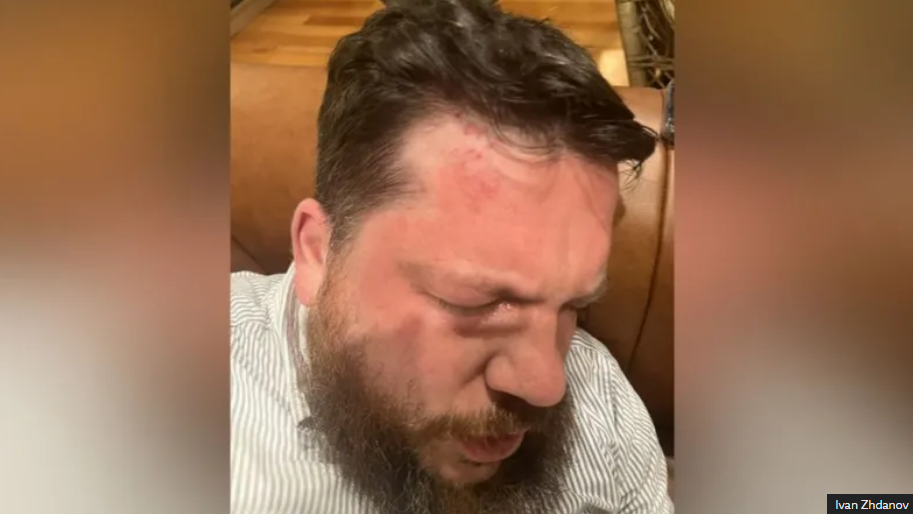 Aleati i Navalnyt, zotohet të vazhdojë luftën kundër Putinit pas sulmit me çekiç në Vilnius