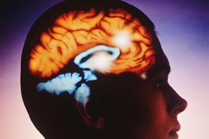 Kirurgjia që synon rajonin e trurit mund të lehtësojë epilepsinë që trajtohet vështirë