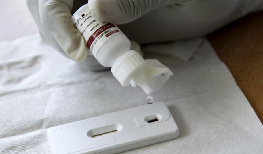 OBSH: Tre milionë njerëz në Evropë jetojnë me AIDS, në gjithë botën afër 39 milionë