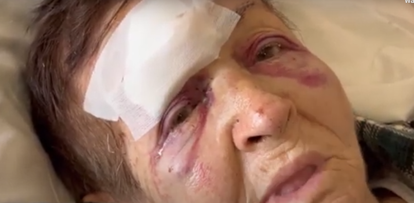 Nusja rrah rëndë vjehrrën në Shkodër (VIDEO)