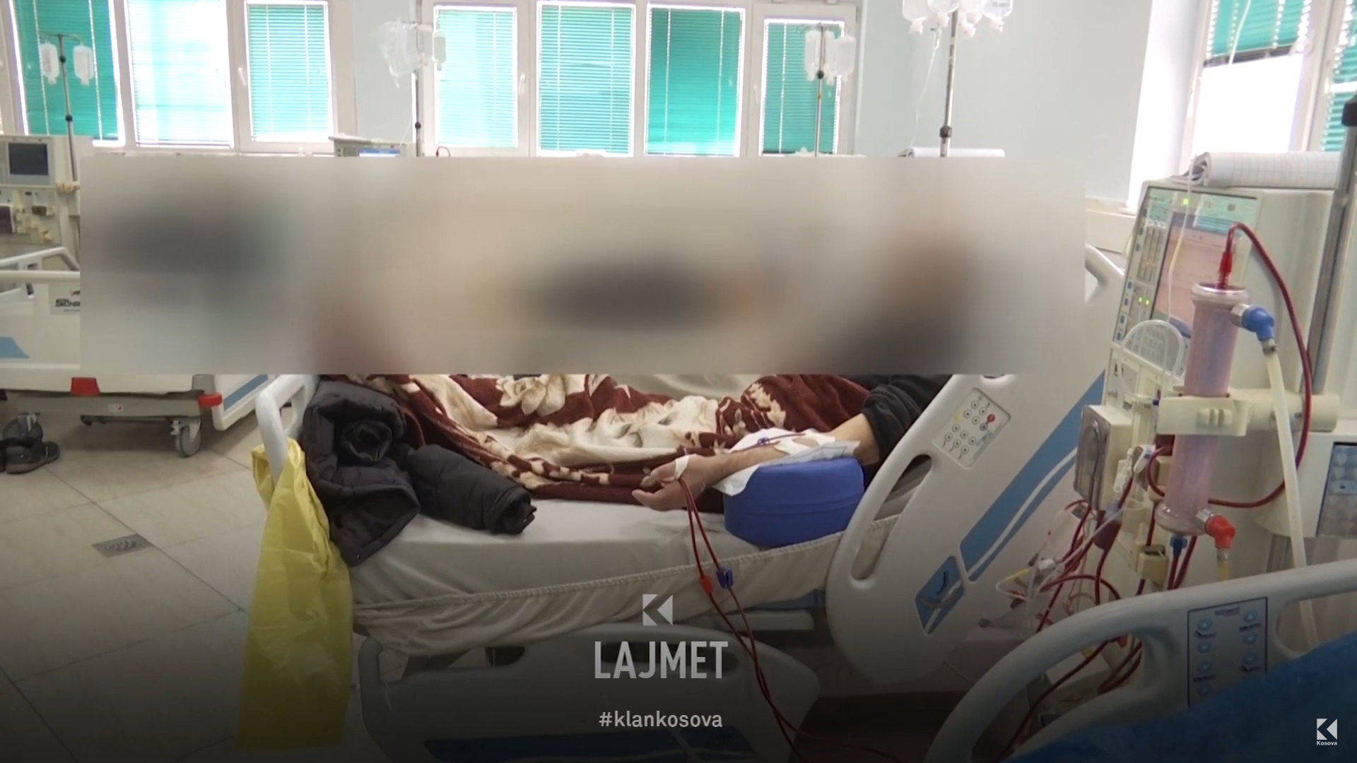 Shumica e aparateve të dializës në QKU jashtë standardeve, sipas kritereve ndërkombëtare