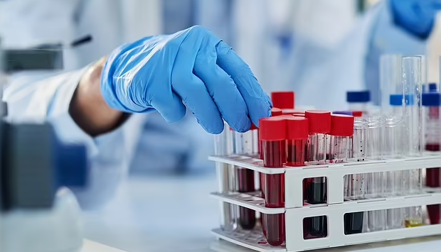 Përparim për kancerin e zorrëve, testi i ri tregon 90% saktësinë e diagnozës