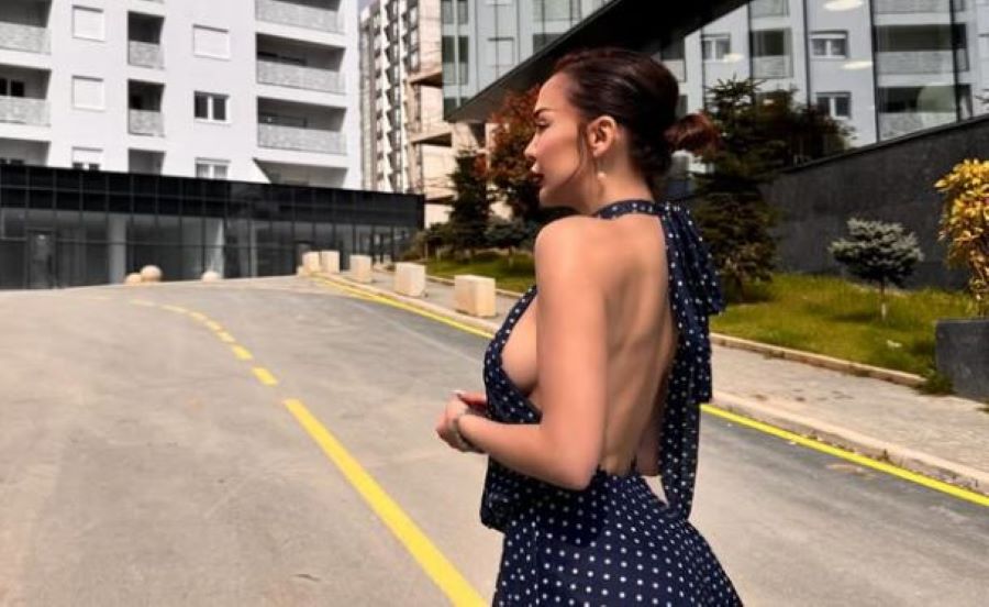 Ana Kabashi “hot” në fotografitë e fundit