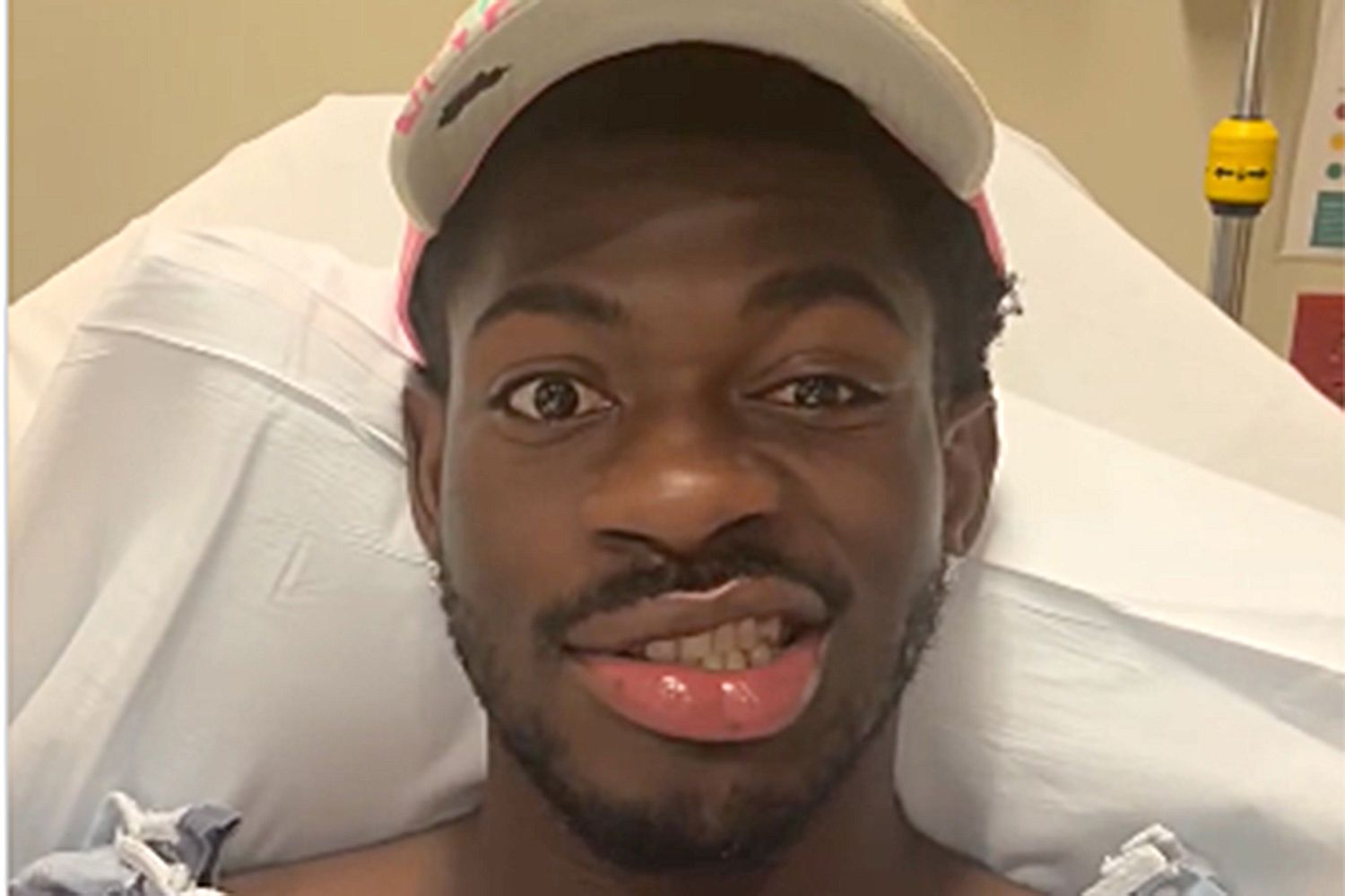 Lil Nas X shtrohet në spital pasi humbi kontrollin e gjysmës së fytyrës