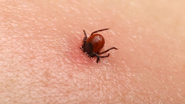 AUV e pranon, përdori produkt që nuk është i dedikuar ekskluzivisht për eliminimin e rriqrave