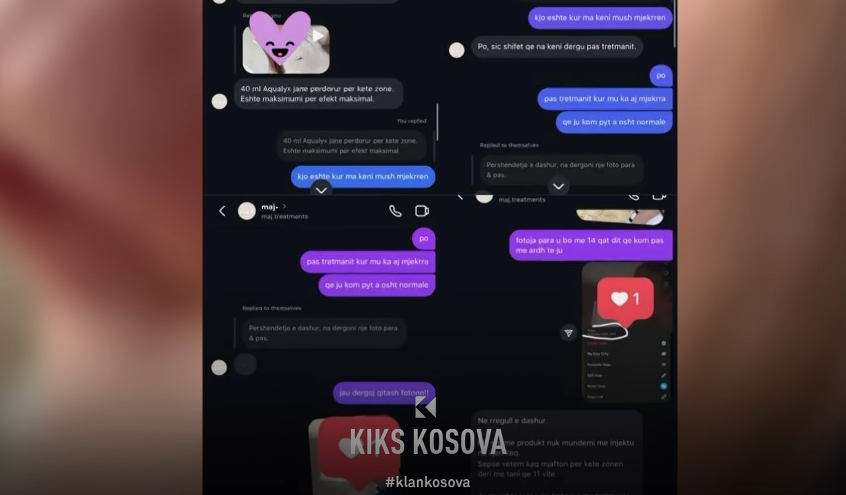 Premtuan se e zvogëlojnë hundën me 400 euro, cila qendër estetike deformoi fytyrat e klienteve? (VIDEO)