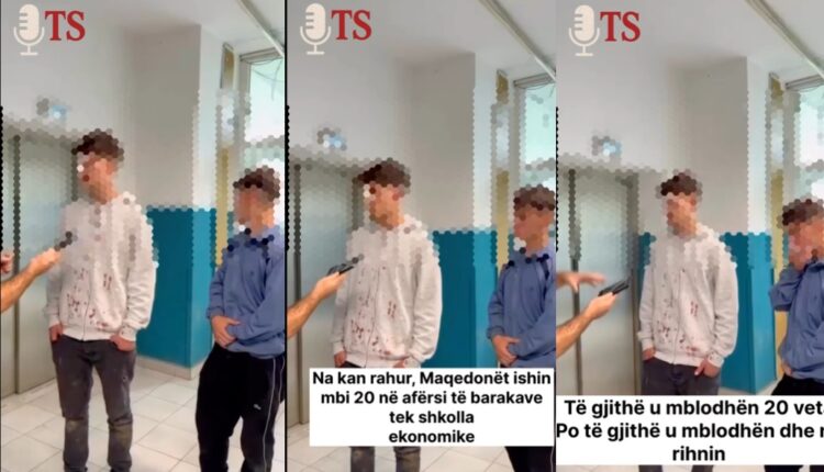 Mbi 20 tifozë të ''Vojvoda'' rrahën barabarisht dy nxënës shqiptarë në Tetovë (VIDEO)