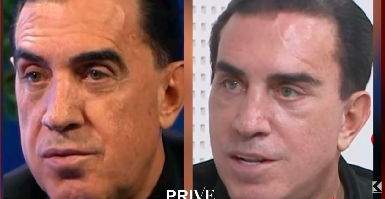 A bëri Enver Idrizi ''lifting" në fytyrë? (VIDEO)