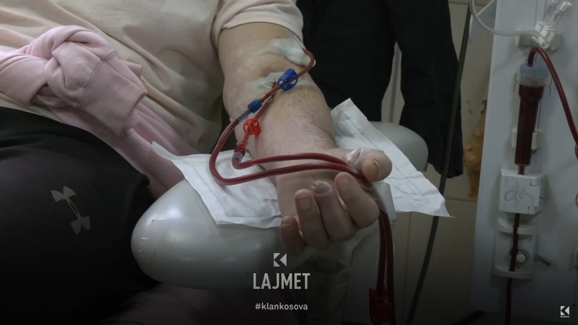 ShSKUK me furnizim të numëruar për dializë (VIDEO)