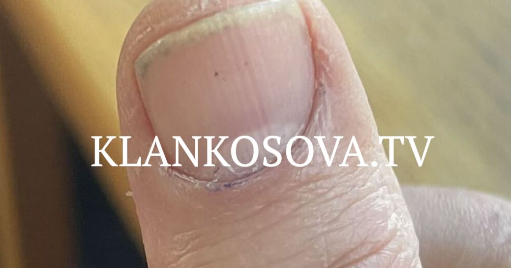 Ankohet qytetari  Ngjyra në gishtin tim u fshi 20 minuta pas votimit në  Meto Bajraktari 