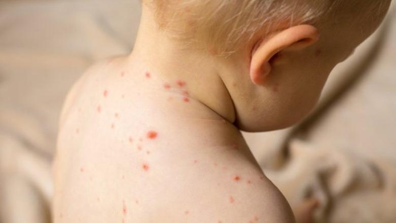 18-raste-me-fruth-ne-shqiperi-pergjate-vitit-2025