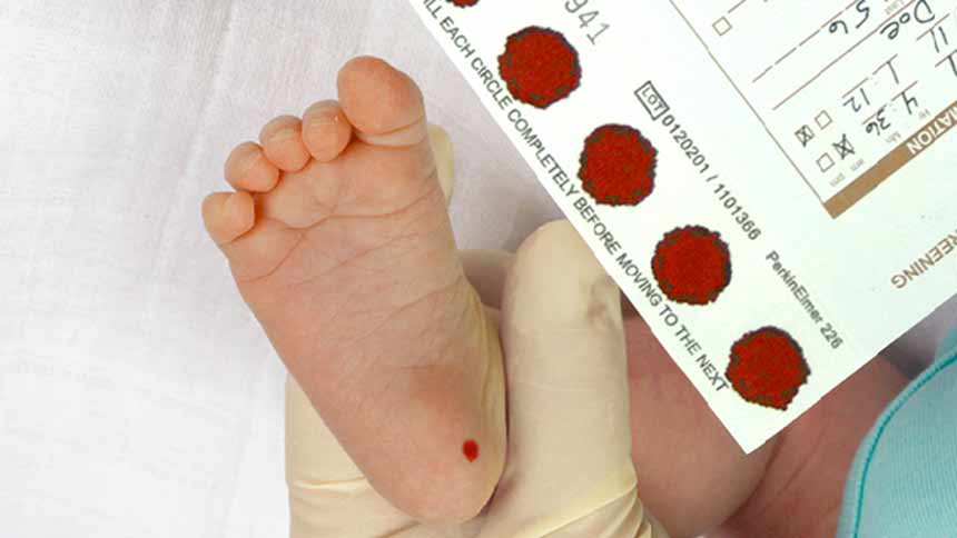 Testi neonatal me një pikë gjaku shpëton jetë: Në QKUK, dy foshnja diagnostikohen me fibrozë cistike