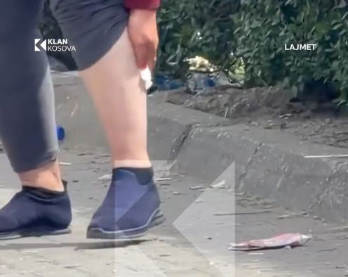 Qentë endacakë sulmojnë një qytetare te Xhamia e Çarshisë në Pejë (VIDEO)